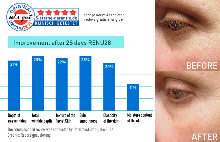 Before and after photos - RENU28 redox gel | Redoxsignaling